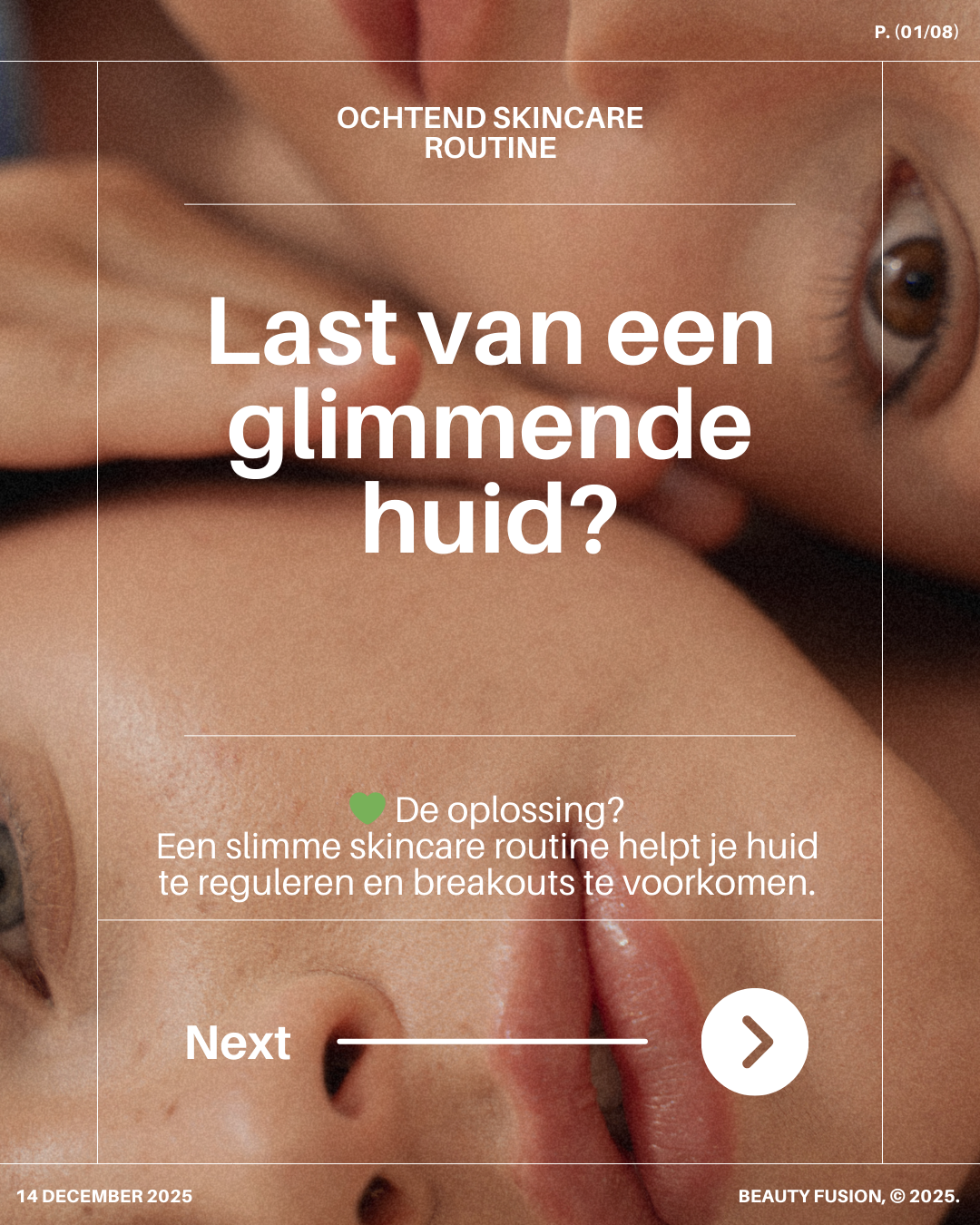 Q&A: Jouw Vragen over Vette Huid Beantwoord + Productaanbevelingen